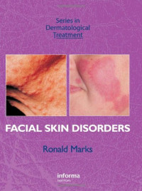 Marks Ronald — Facial Skin Disorders