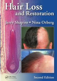 Otberg, Nina; Shapiro, Jerry — Hair Loss and Restoration