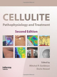 Mitchel P. Goldman, Doris Hexsel — Cellulite: Pathophysiology and Treatment, 2nd Edition (Basic and Clinical Dermatology)
