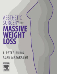 J. Peter Rubin, Alan Matarasso — Aesthetic Surgery After Massive Weight Loss