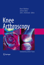 Anthony Schena, Glen Ross MD (auth.), John C. Richmond, James V. Bono, Brian P. McKeon (eds.) — Knee Arthroscopy