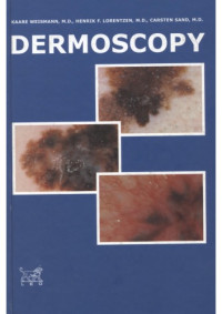 Kaare Weismann; Henrik F Lorentzen; Carsten Sand; LEO Pharma — Dermoscopy