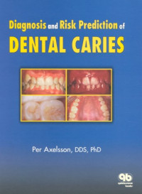Per Axelsson — Diagnosis and Risk Prediction of Dental Caries, Volume 2