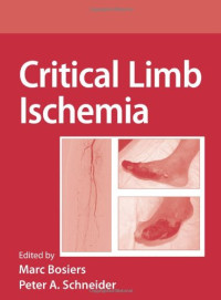Peter Schneider, Marc Bosiers — Critical Limb Ischemia