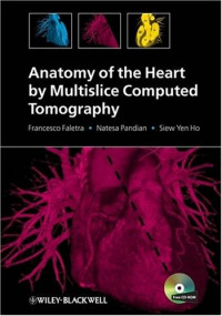 Francesco Faletra, Natesa Pandian, Siew Yen Ho — Anatomy of the Heart by Multislice Computed Tomography
