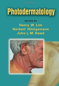 Henry W. Lim, Herbert Honigsmann, John Hawk — Photodermatology
