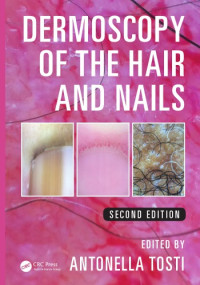 Tosti, Antonella — Dermoscopy of the hair and nails
