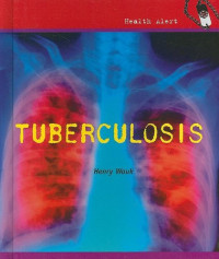 Henry Wouk — Tuberculosis