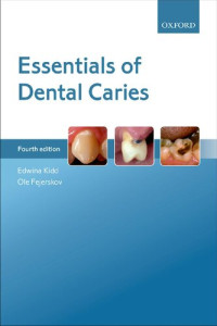 Edwina Kidd; Ole Fejerskov — Essentials of Dental Caries