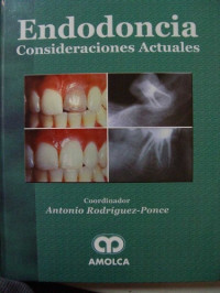 Antonio  Rodriguez-Ponce — Endodoncia Consideraciones Actuales (Spanish Edition)