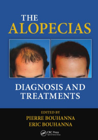 Bouhanna, Eric; Bouhanna, Pierre — Alopecias : diagnosis and treatments