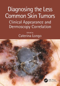 Caterina Longo — Diagnosing the Less Common Skin Tumors Clinical Appearance and Dermoscopy Correlation