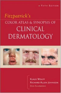Klaus Wolff, Richard. Johnson, Richard Suurmond — Fitzpatrick's Color Atlas & Synopsis of Clinical Dermatology