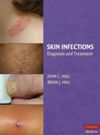 Brian J. Hall, John C. Hall MD — Skin Infections: Diagnosis and Treatment