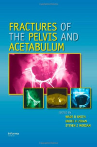 Wade  R. Smith, Bruce H. Ziran, Steven J Morgan — Fractures of the Pelvis and Acetabulum