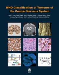 coll. — WHO Classification of Tumours of the Central Nervous System