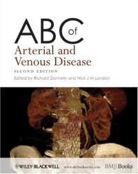 Richard Donnelly, Nick J. M. London — ABC of Arterial and Venous Disease (ABC Series)