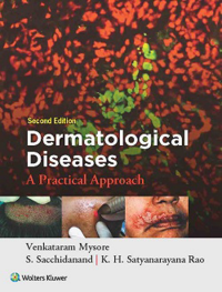 Venkataram Mysore; K. H. Satyanarayana Rao; S. Sacchidanand — Dermatological Diseases: A Practical Approach
