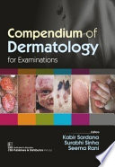 Kabir Sardana (Editor), Surabhi Sinha (Editor), Seema Rani (Editor) — Compendium of Dermatology for Examinations