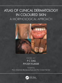 P C Das, Piyush Kumar, (eds.) — Atlas of Clinical Dermatology in Coloured Skin: A Morphological Approach