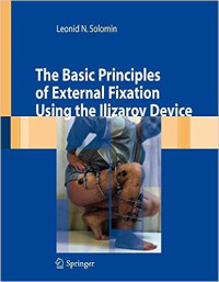 Leonid N.Solomin — The Basic Principles of External Fixation Using the Ilizarov Device