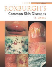 Marks, R. — Roxburgh's Common Skin Diseases