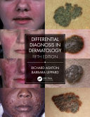 Richard Ashton, Barbara Leppard — Differential Diagnosis in Dermatology