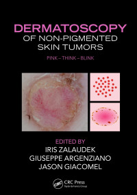 Zalaudek, Iris, Argenziano, Giuseppe, Giacomel, Jason — Dermatoscopy of Non-Pigmented Skin Tumors