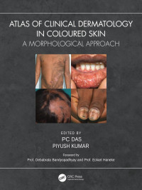 P C Das, Piyush Kumar — Atlas of Clinical Dermatology in Coloured Skin: A Morphological Approach