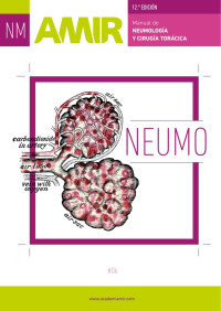 Iceberg Visual — Neumologia 12a Edicion